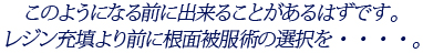 このようになる前に出来ることがあるはずです。レジン充填より前に根面被服術の選択を・・・・。